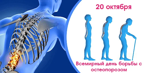 Всемирный день борьбы с остеопорозом