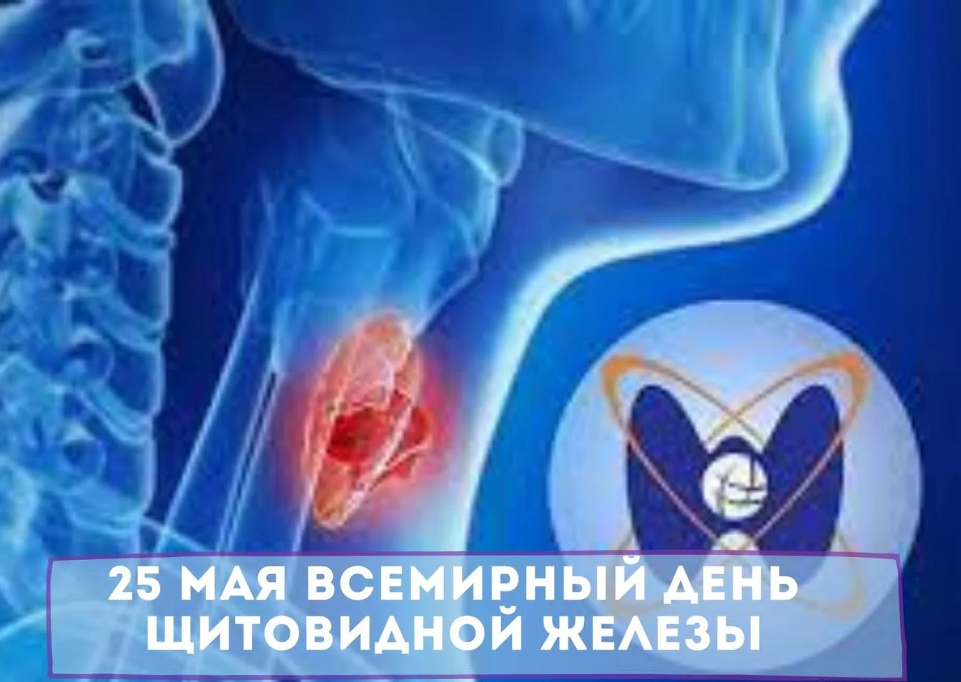 25 мая Всемирный день щитовидной железы