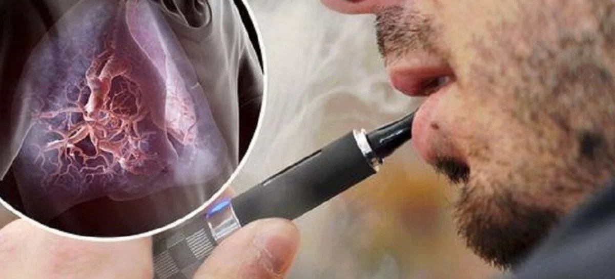 EVALI - болезнь вейперов