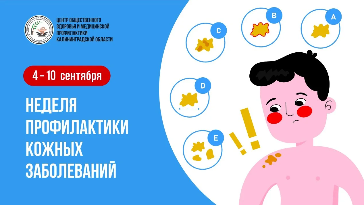 Неделя профилактики кожных заболеваний
