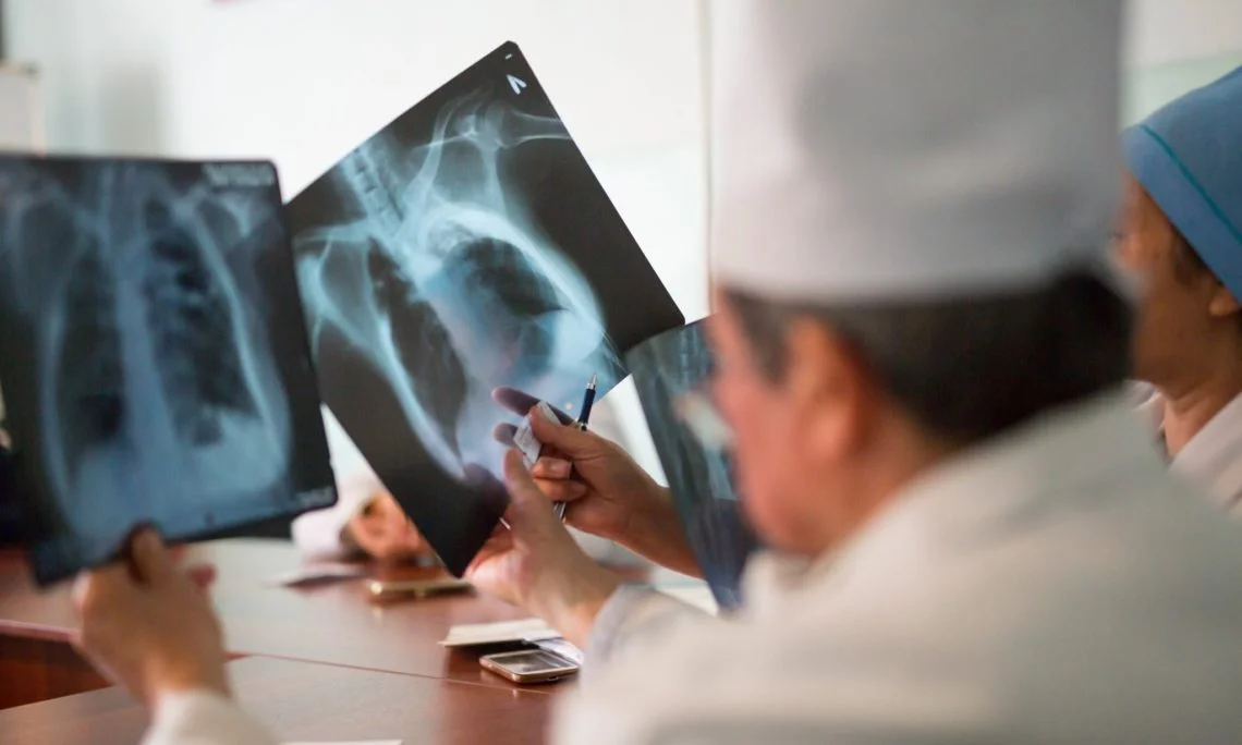 Туберкулёз и диспансерное наблюдение.