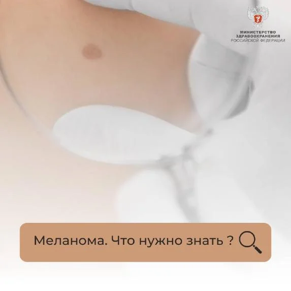 Меланома. Что нужно знать ?