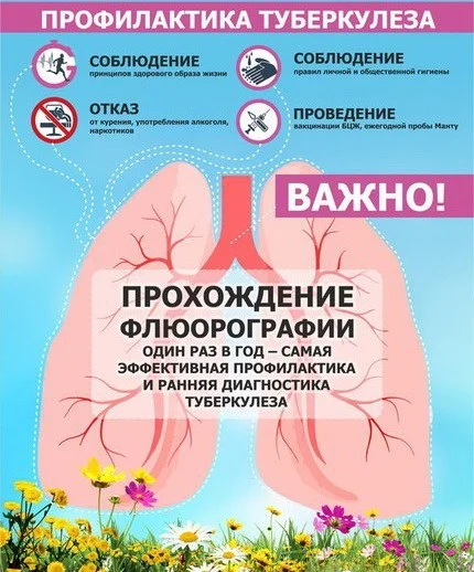 Флюорография