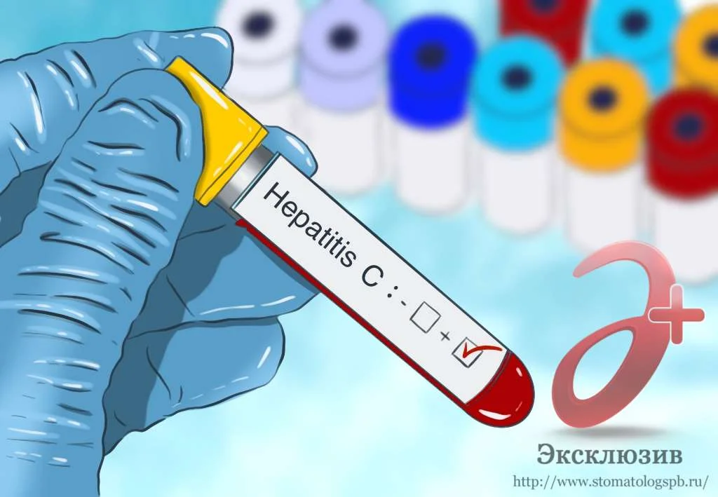 Что важно знать, если человек инфицирован вирусом гепатита С?