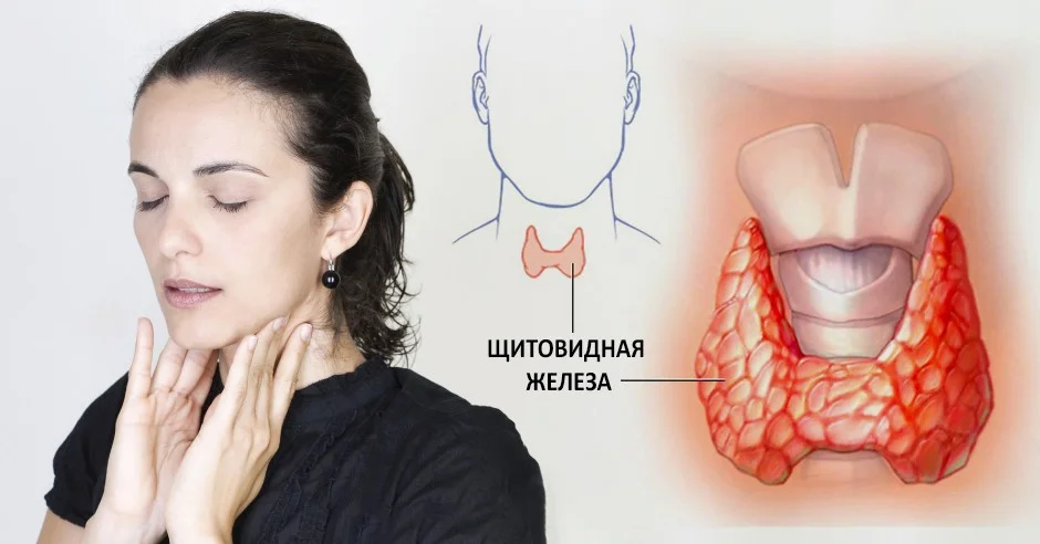 thyroid.jpg