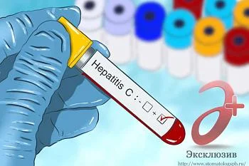 Что важно знать, если человек инфицирован вирусом гепатита С?