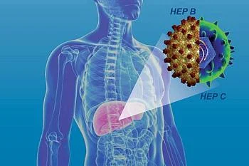 Вирусные гепатиты В и С: что должен знать каждый