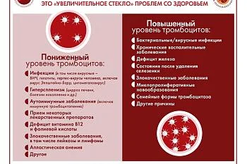 Инфографика