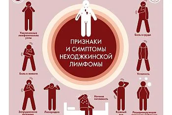 Инфографика