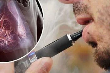 EVALI - болезнь вейперов