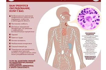 Инфографика