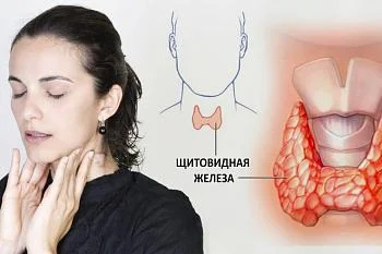Статья на тему "Что необходимо знать о заболеваниях щитовидной железы"