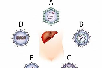 Вирусные гепатиты