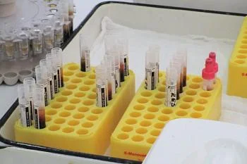 Состоится консультативный прием по вопросам ЭКО по ОМС Состоится консультативный прием по вопросам ЭКО по ОМС