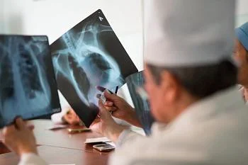 Туберкулёз и диспансерное наблюдение.