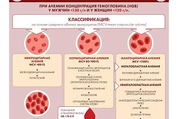 Инфографика