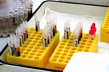 В Калининградской области стартует исследование популяционного иммунитета к COVID-19 В Калининградской области стартует исследование популяционного иммунитета к COVID-19