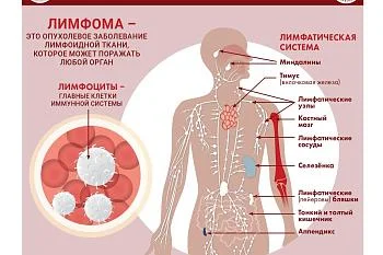 Инфографика