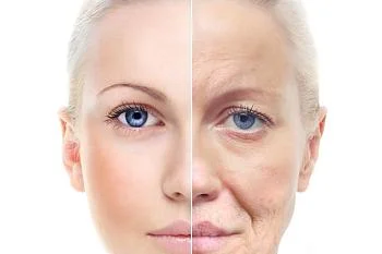 ЧТО ТАКОЕ «САХАРНОЕ ЛИЦО»?