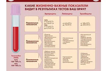 Инфографика