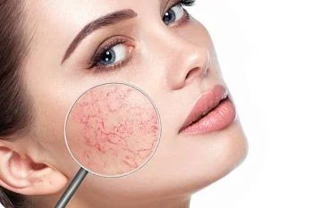 КУПЕРОЗ: ПРИЧИНЫ И ПОСЛЕДСТВИЯ.