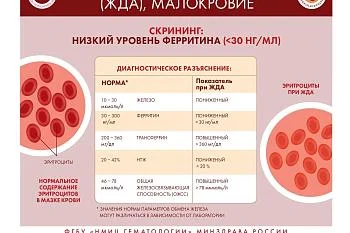 Инфографика