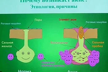 Профилактика кожных заболеваний. 28-29 января МАОУ гимназия № 32 и МАОУ СОШ № 38 г. Калининграда
