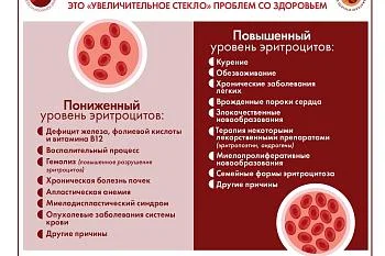 Инфографика