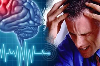 "Признаки инсульта и оказание первой помощи"