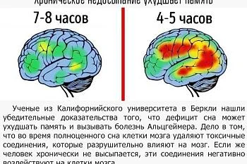 Интересные факты о мозге