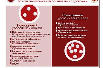 Инфографика