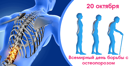 Всемирный день борьбы с остеопорозом